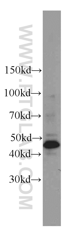 WB analysis of HeLa using 22230-1-AP