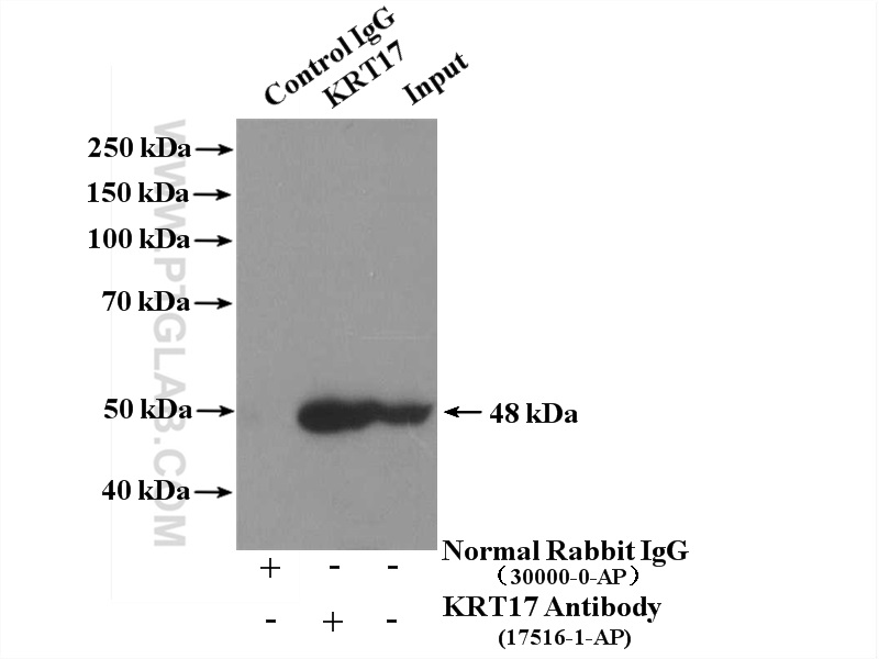 IP experiment of A431 using 17516-1-AP