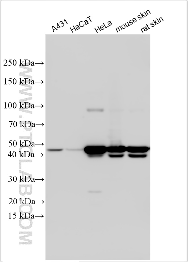 WB analysis using 17516-1-AP