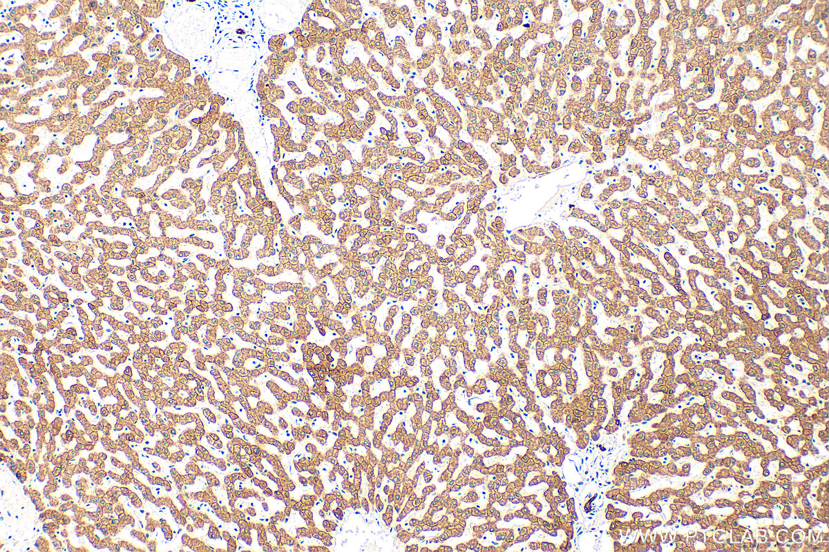 IHC staining of human liver using 10830-1-AP