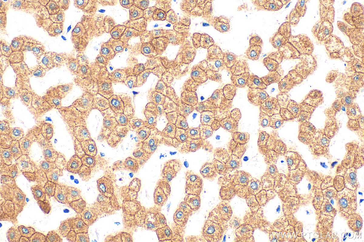 IHC staining of human liver using 10830-1-AP