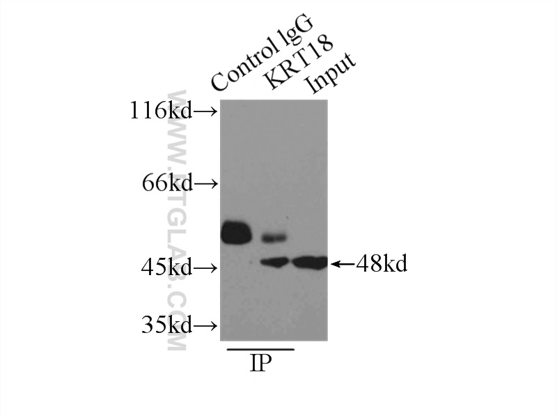 IP experiment of A431 using 10830-1-AP