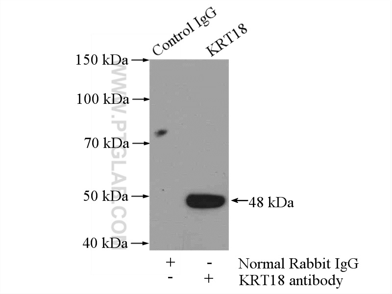 IP experiment of A431 using 18708-1-AP