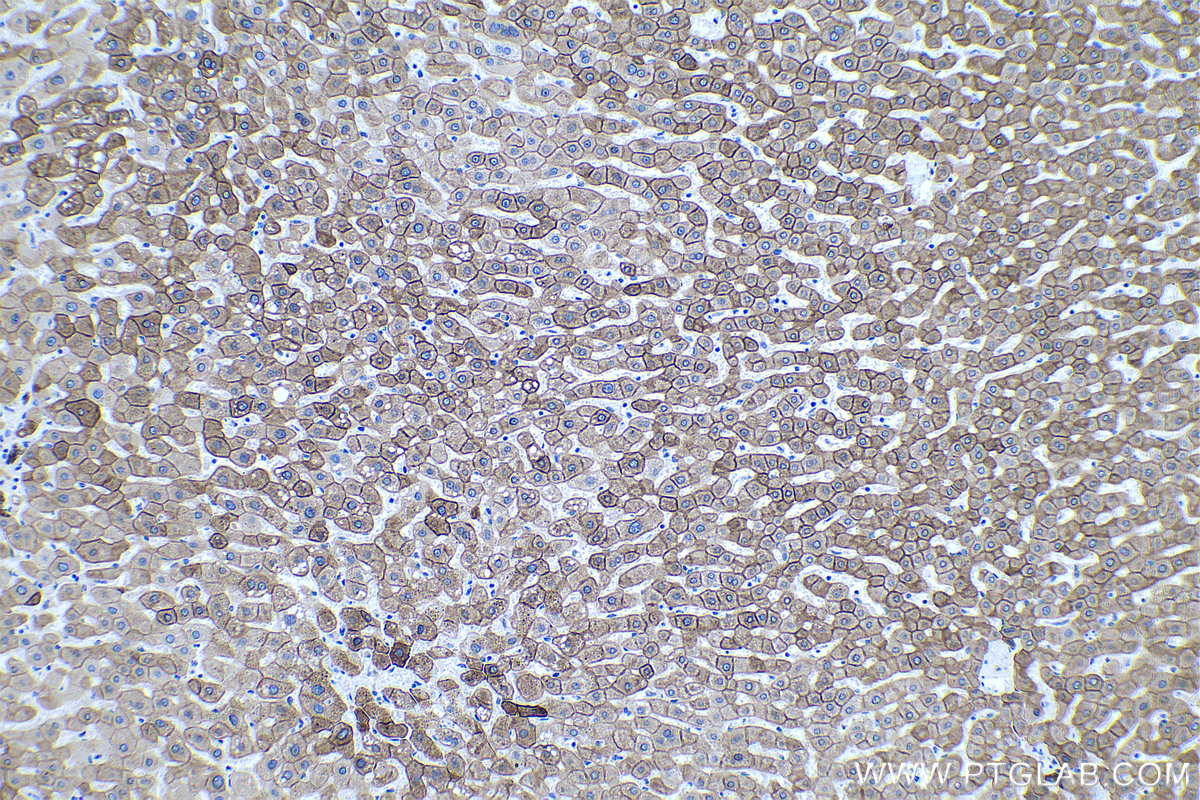 IHC staining of human liver using 66187-1-Ig IHC staining of human liver using 66187-1-Ig