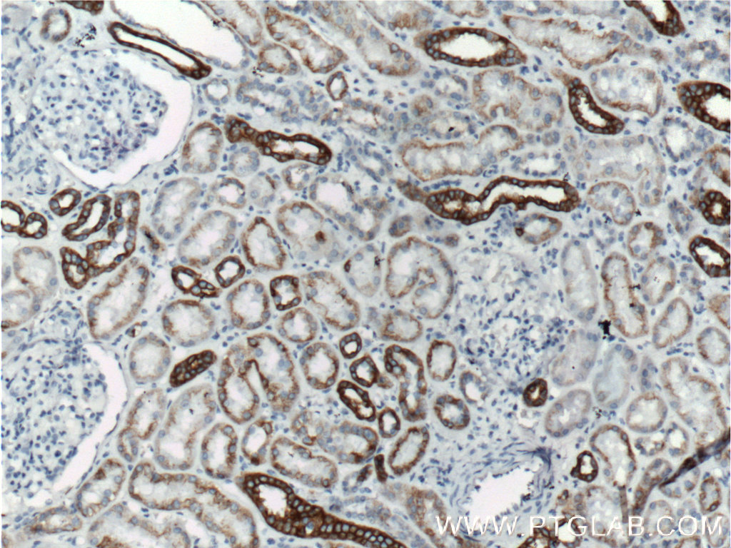 IHC staining of human kidney using 66187-1-Ig (same clone as 66187-1-PBS)
