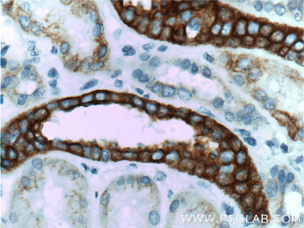 IHC staining of human kidney using 66187-1-Ig