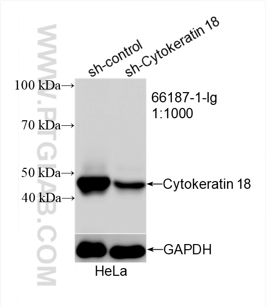 WB analysis of HeLa using 66187-1-Ig