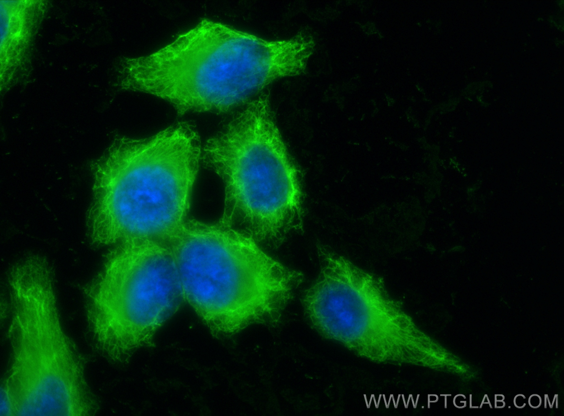 IF Staining of HepG2 using 82817-5-RR (same clone as 82817-5-PBS)