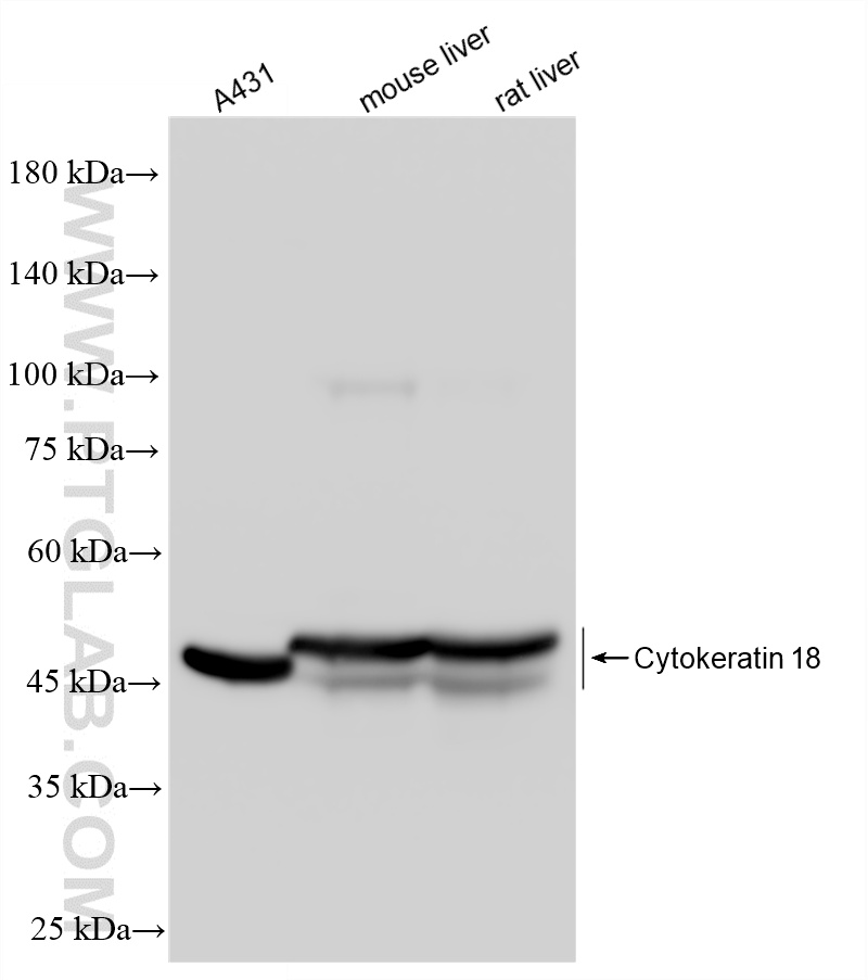 WB analysis using 82817-5-RR WB analysis using 82817-5-RR