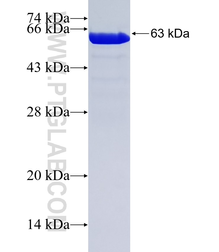 KRT18 fusion protein Ag1260 SDS-PAGE