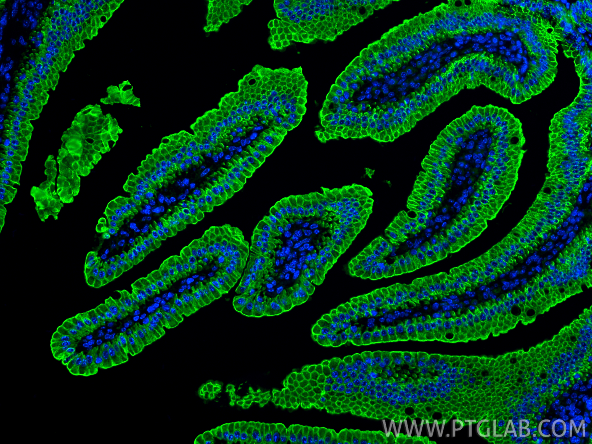 IF Staining of mouse small intestine using 10712-1-AP
