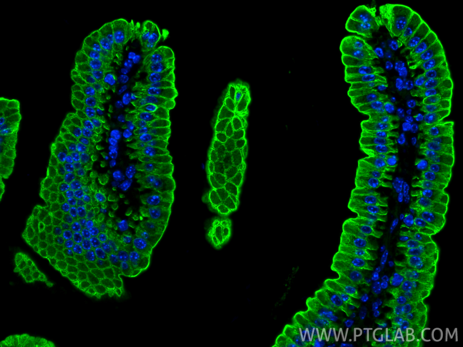 IF Staining of mouse small intestine using 10712-1-AP