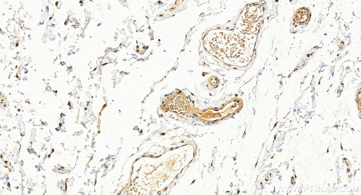 IHC staining of human colon using 14965-1-AP