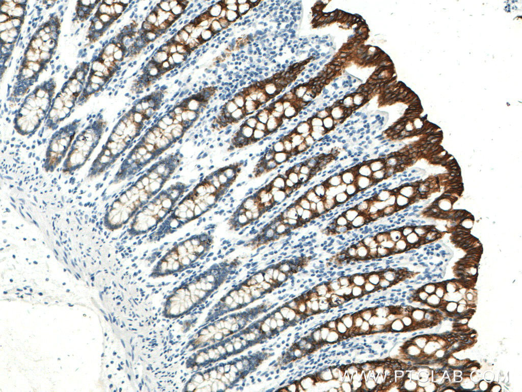 IHC staining of human colon using 60187-1-Ig