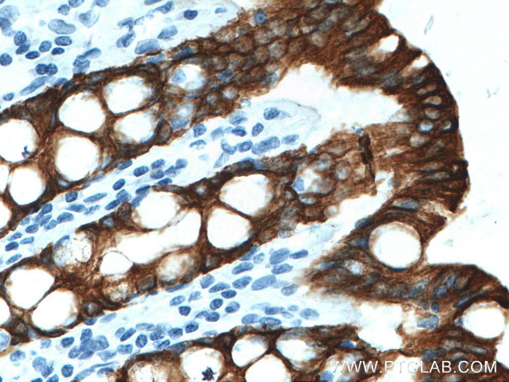 IHC staining of human colon using 60187-1-Ig (same clone as 60187-1-PBS)