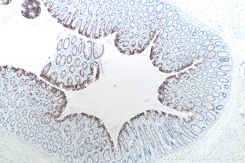 IHC staining of human colon using 60187-1-Ig IHC staining of human colon using 60187-1-Ig