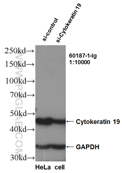 WB analysis of HeLa using 60187-1-Ig