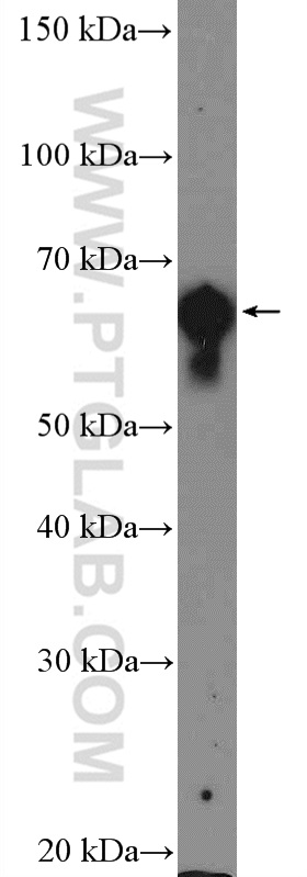 Cytokeratin 2e Polyclonal antibody