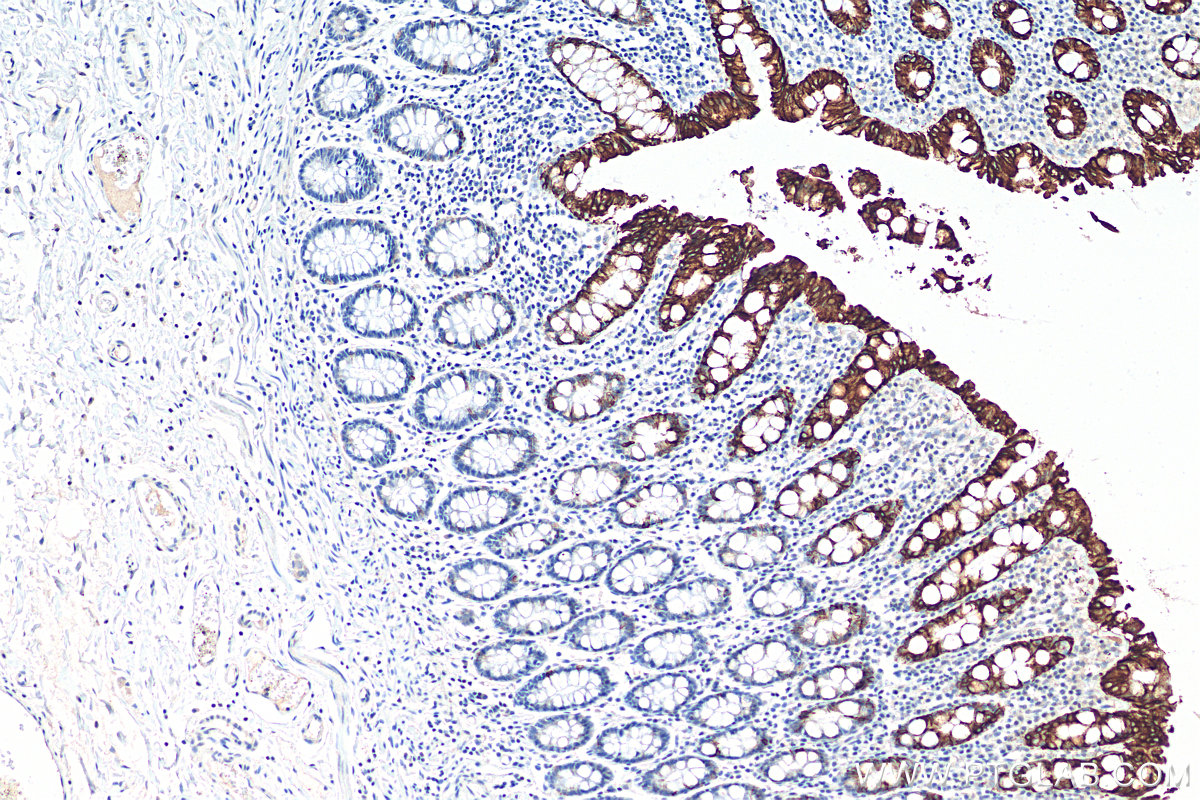 IHC staining of human colon using 17329-1-AP