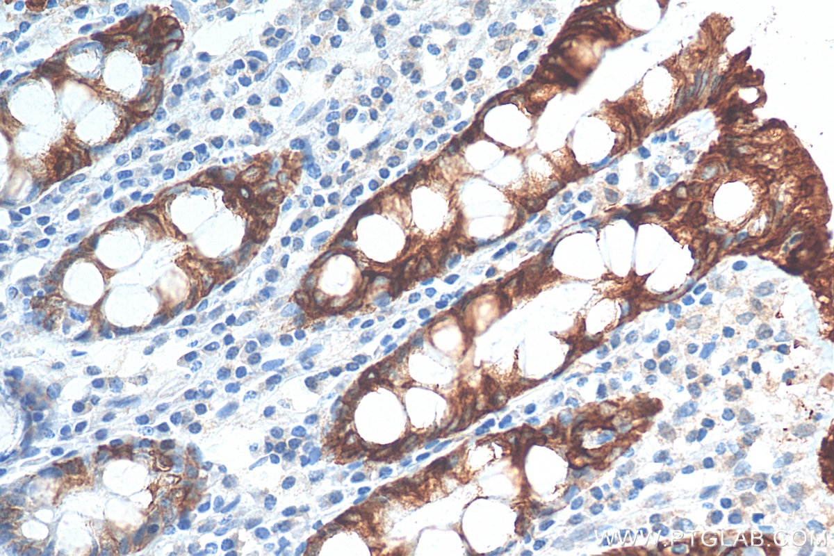 IHC staining of human colon using 17329-1-AP