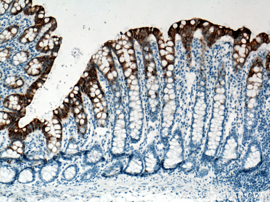 IHC staining of human colon using 60183-1-Ig