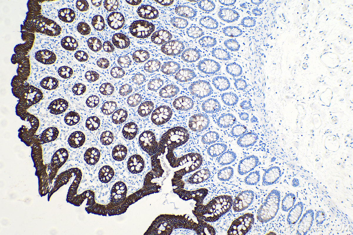 IHC staining of human colon using 60183-1-Ig
