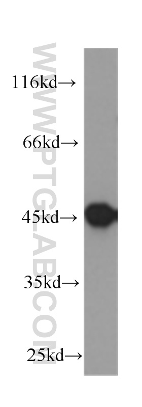 WB analysis of COLO 320 using 60183-1-Ig