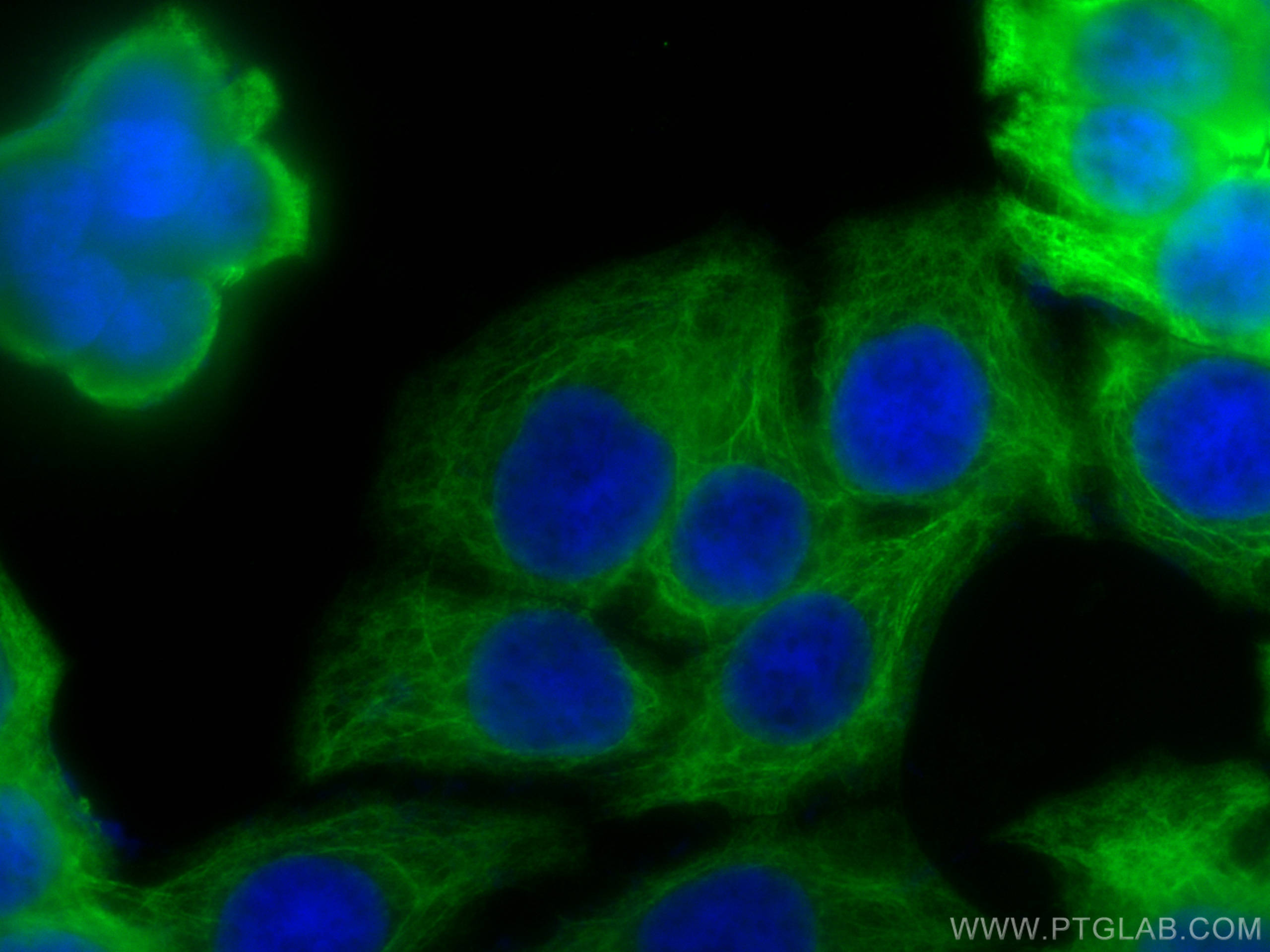 IF Staining of HT-29 using 82428-1-RR (same clone as 82428-1-PBS)