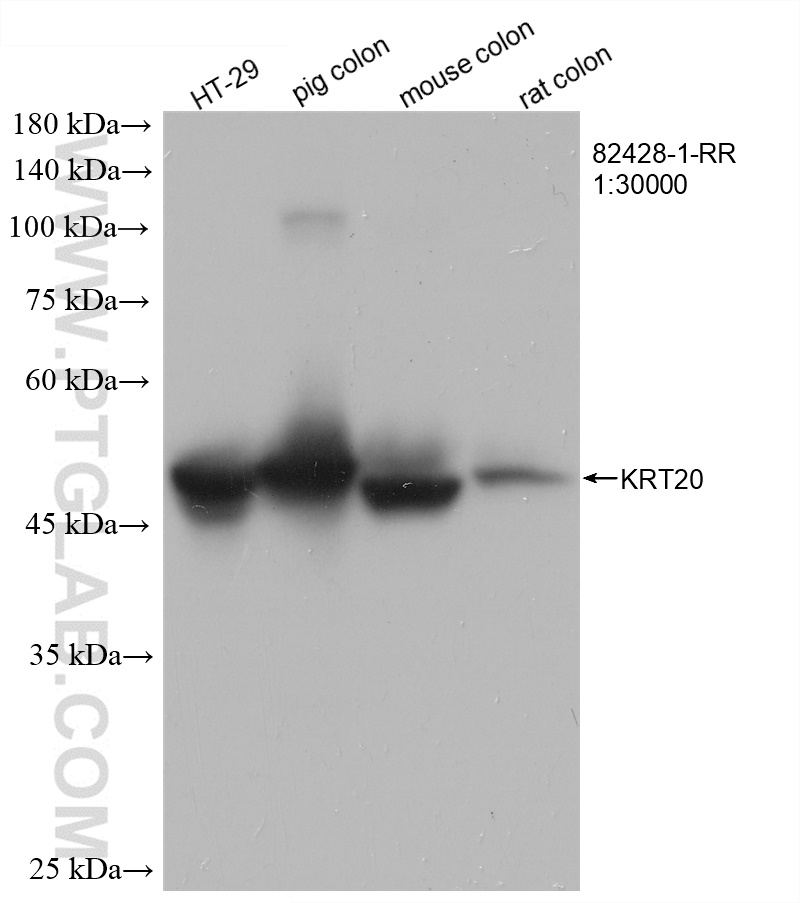 WB analysis using 82428-1-RR (same clone as 82428-1-PBS)