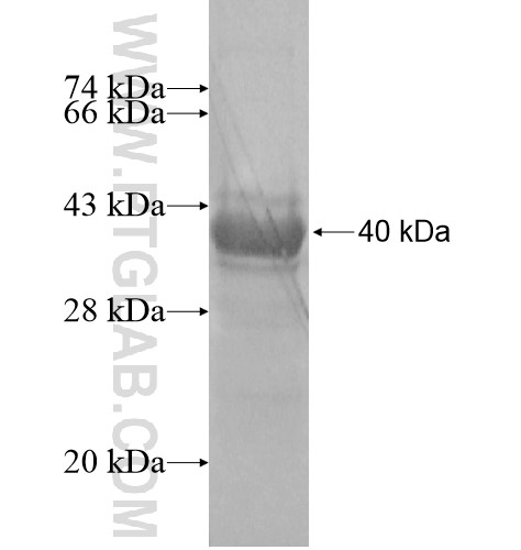 KRT222P fusion protein Ag15472 SDS-PAGE KRT222P fusion protein Ag15472 SDS-PAGE