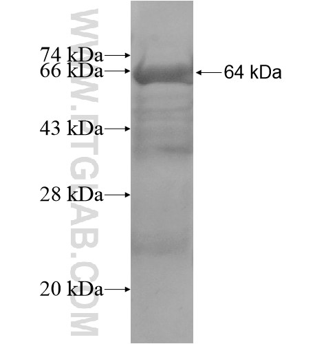 KRT222P fusion protein Ag15493 SDS-PAGE KRT222P fusion protein Ag15493 SDS-PAGE