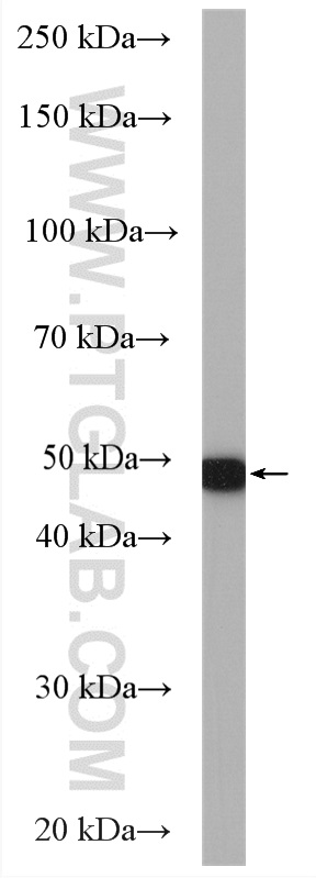 WB analysis of BxPC-3 using 24049-1-AP