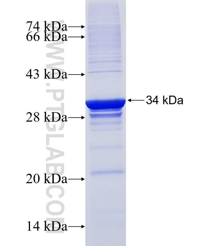 KRT25 fusion protein Ag18926 SDS-PAGE KRT25 fusion protein Ag18926 SDS-PAGE