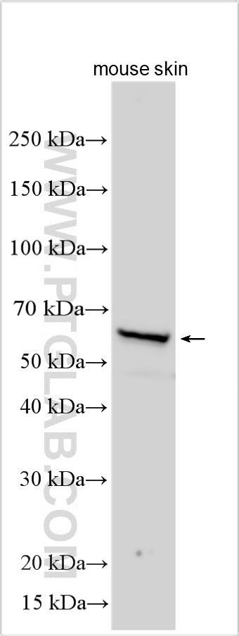 WB analysis using 22813-1-AP