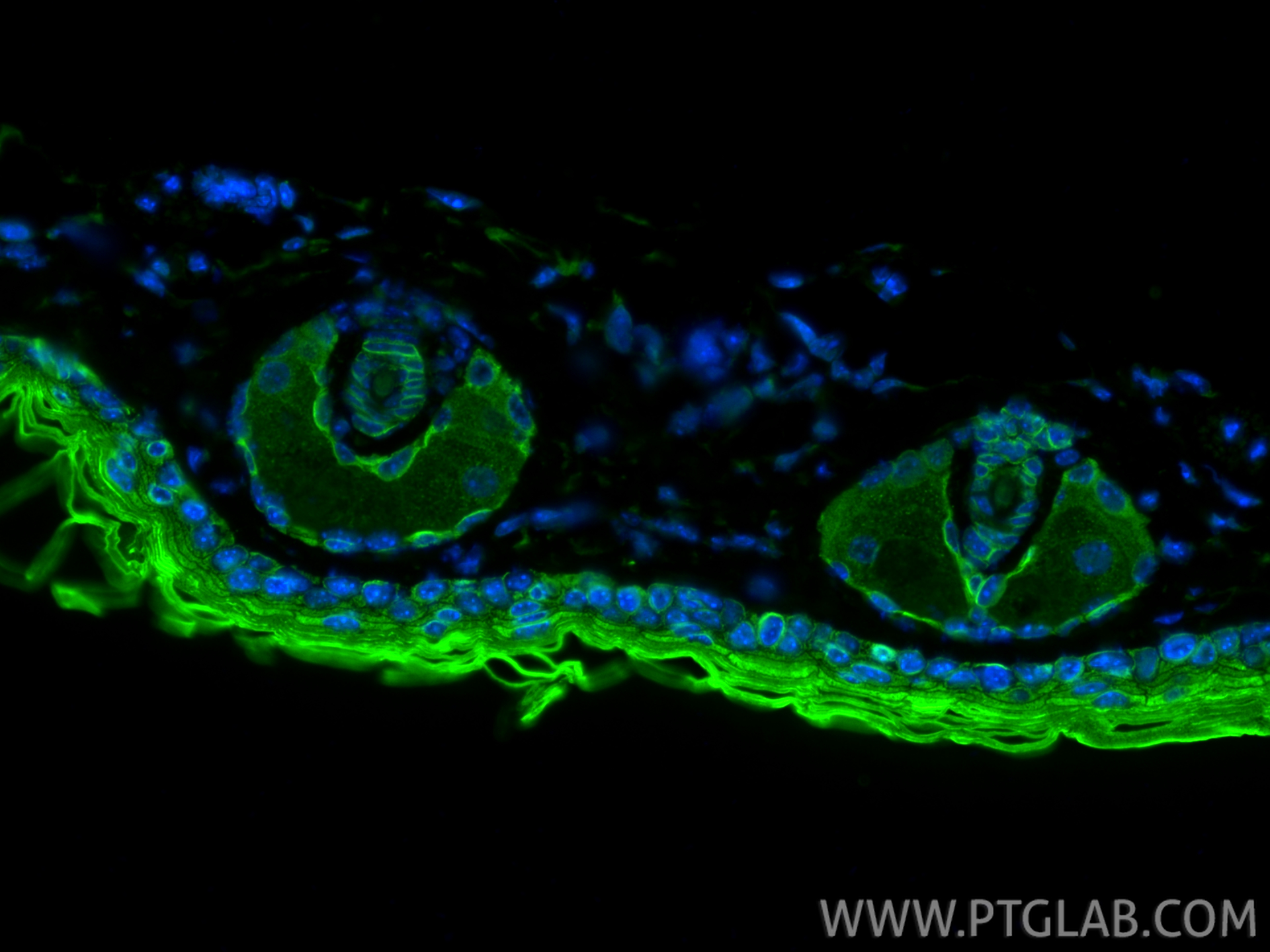 IF Staining of mouse skin using 16850-1-AP IF Staining of mouse skin using 16850-1-AP