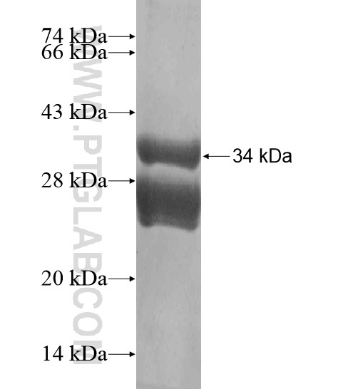 KRT32 fusion protein Ag20165 SDS-PAGE KRT32 fusion protein Ag20165 SDS-PAGE