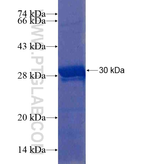 KRT38 fusion protein Ag19197 SDS-PAGE KRT38 fusion protein Ag19197 SDS-PAGE