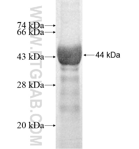 KRT4 fusion protein Ag10075 SDS-PAGE