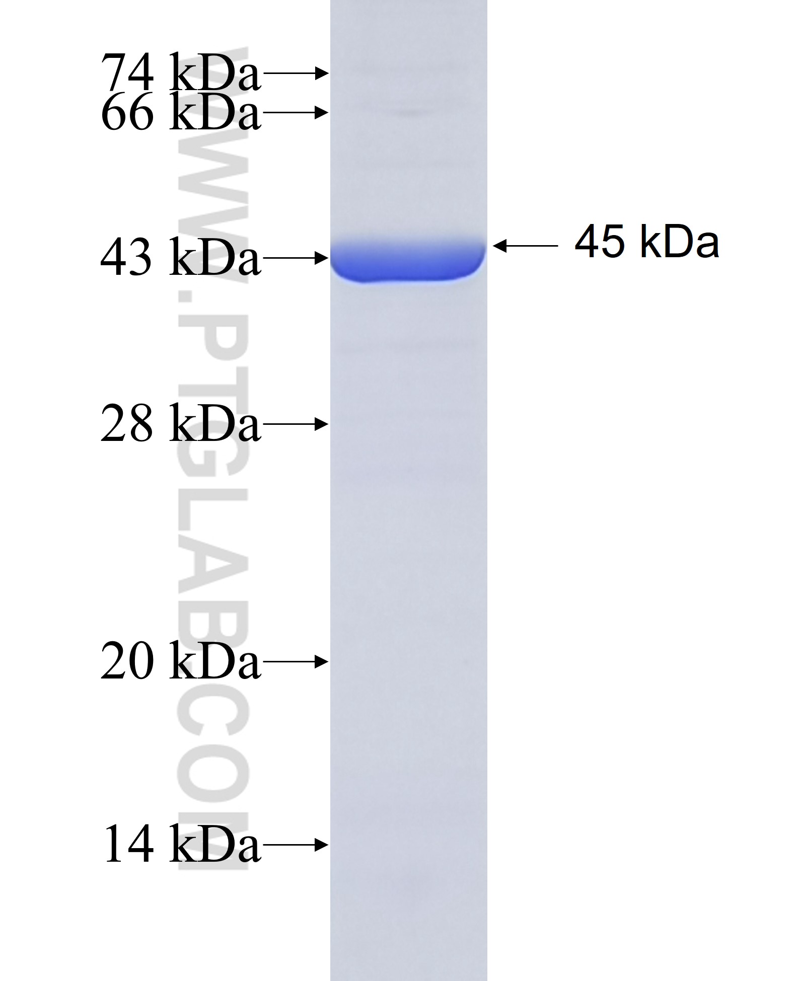 KRT4 fusion protein Ag10075 SDS-PAGE