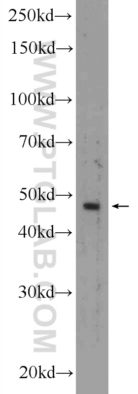 WB analysis of A431 using 25398-1-AP