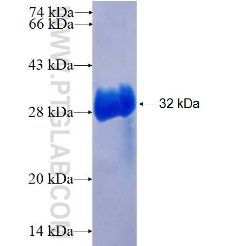 KRT5 fusion protein Ag25436 SDS-PAGE