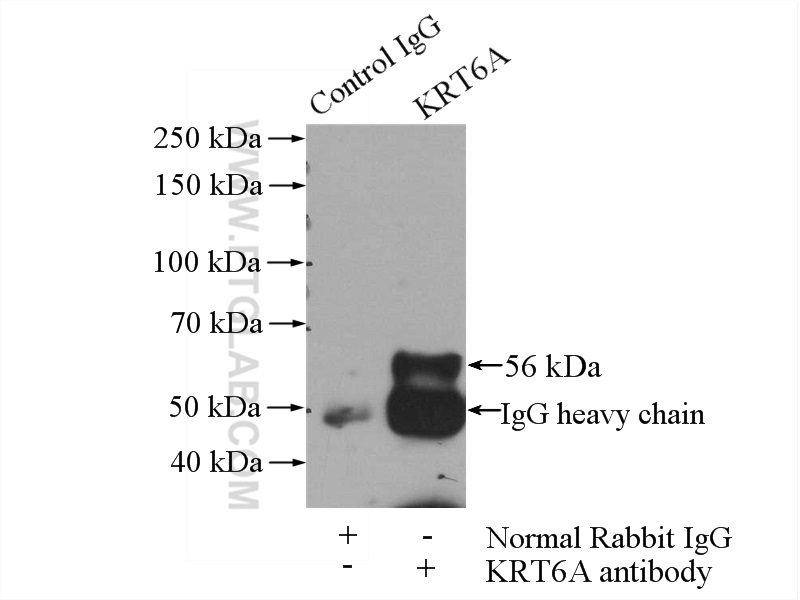 IP experiment of HeLa using 16853-1-AP