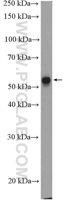 WB analysis of A431 using 10590-1-AP