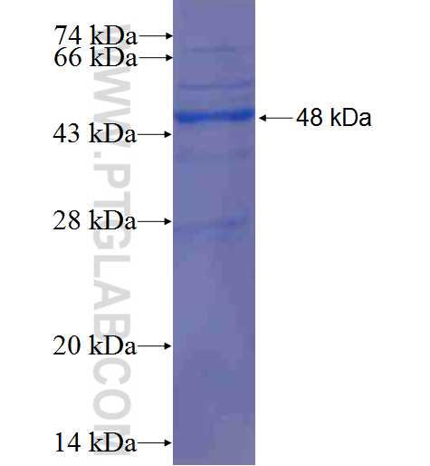 KRT6A fusion protein Ag0882 SDS-PAGE