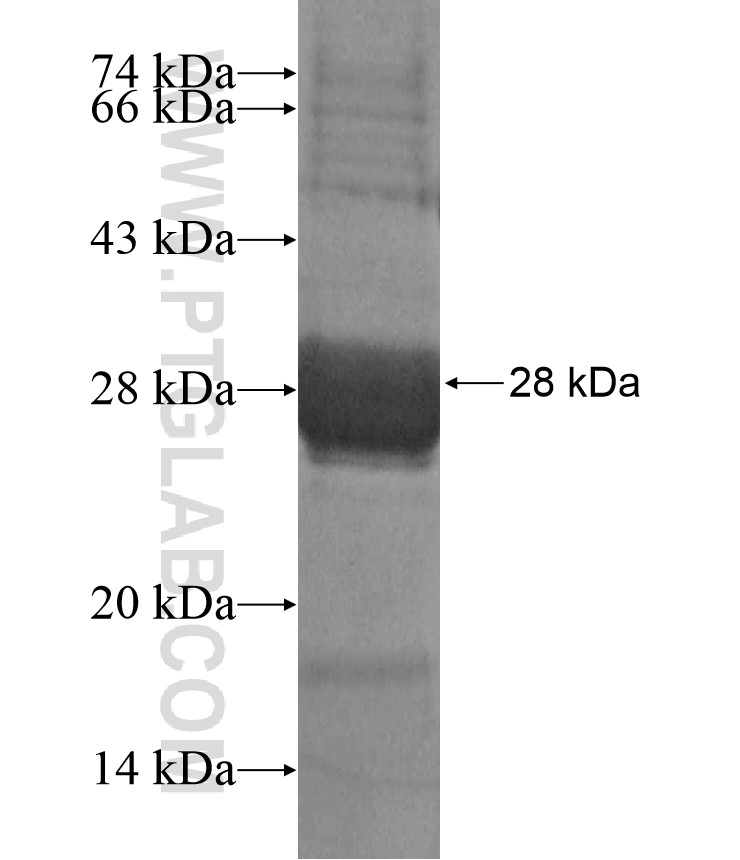 KRT6A fusion protein Ag17365 SDS-PAGE KRT6A fusion protein Ag17365 SDS-PAGE
