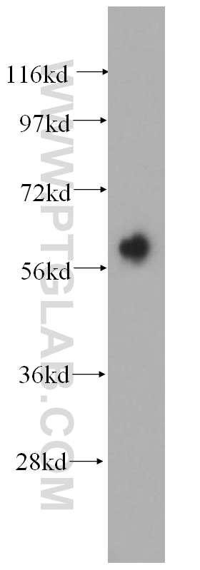 WB analysis of mouse skin using 17391-1-AP