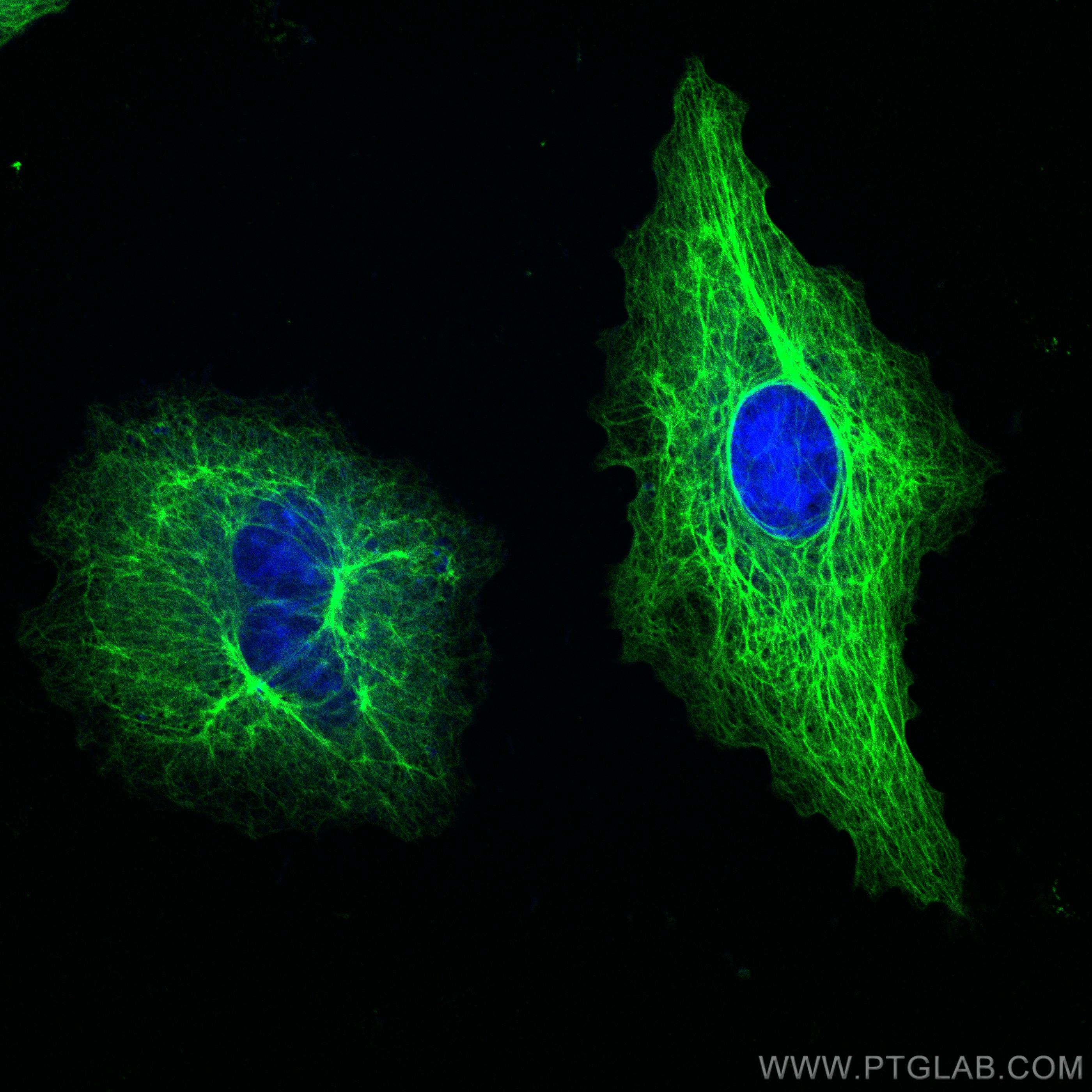 IF Staining of A549 using 22208-1-AP