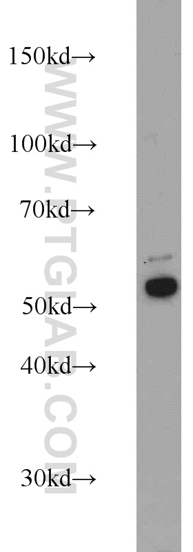 Cytokeratin 7 Polyclonal antibody