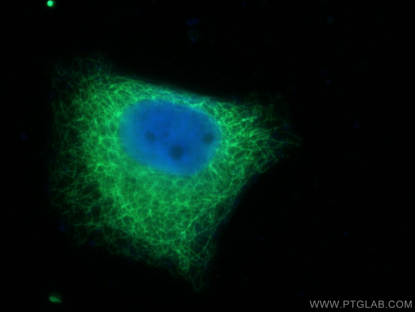 Cytokeratin 7-specific