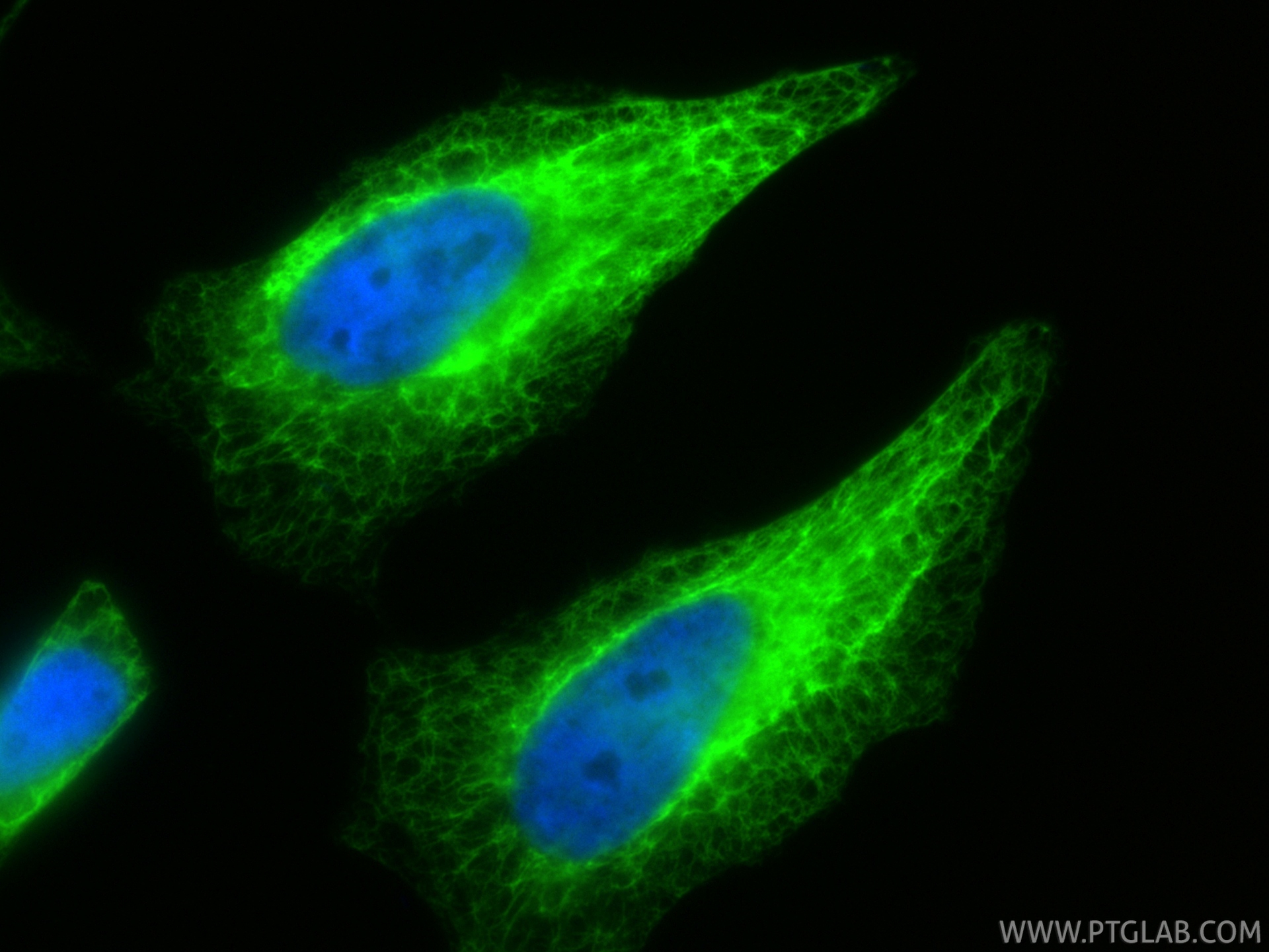 IF Staining of HeLa using 17513-1-AP